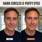 Dark circles and puffy eyes: tonight, patches on
