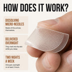 How does it work: dissolving micro-needles